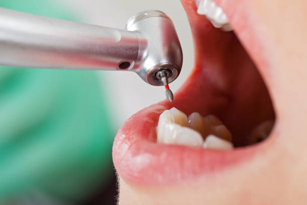 Best Pediatric Emergency Dentist in San Pablo, NM
